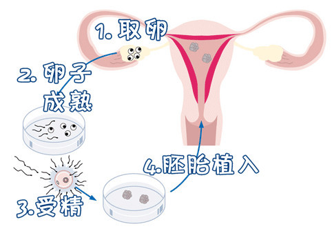 正规黑客追款联系方式是多少